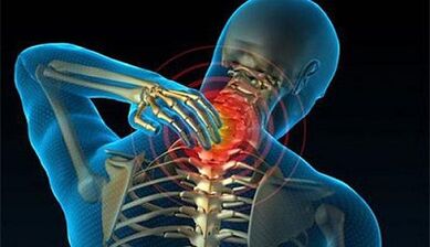 Bachadon umurtqa pog'onasining osteokondrozining alomatlari