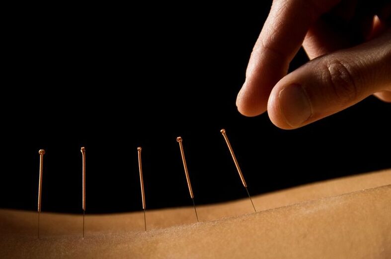 bel og'rig'i uchun akupunktur